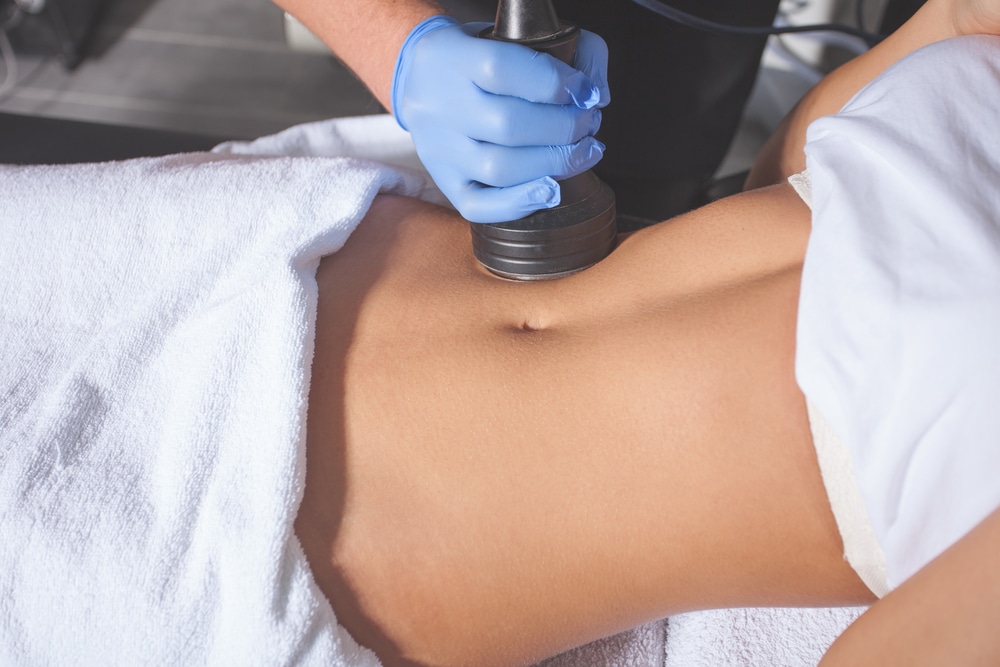CoolSculpting in Indianapolis, IN